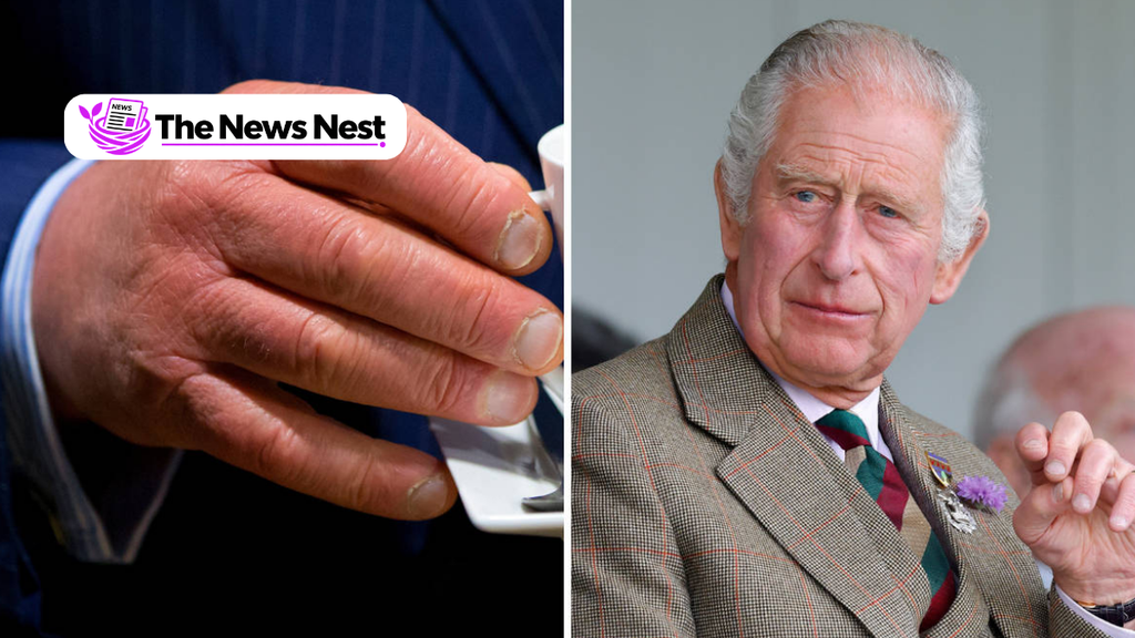 Prince Charles Fingers: What We Know About His Swollen Hands Prince Charles Fingers